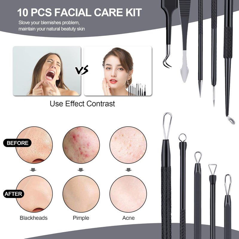 MENOLY Pimple Popper Tool Kit 10 Pcs Blackhead Remover Tool Zit Popper for Blemish, Pimple Comedone Extractor Acne Tool for Blackheads, Acnes, Whiteheads Nose Face Tools with Leather Bag - Image 4